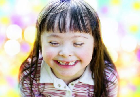 Smiling little girl with Downs Syndrome